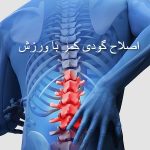 اصلاح گودی کمر با ورزش